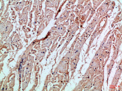 MIA Antibody