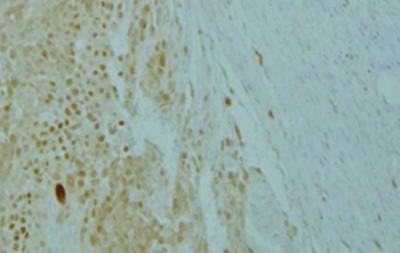 Mouse Human Microphthalmia Transcription Factor (MiTF) Antibody