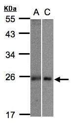 MID1IP1 Rabbit Polyclonal Antibody