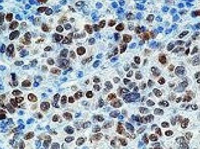 Mouse Human Microphthalmia Transcription Factor (MiTF) Antibody