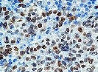 Mouse Human Microphthalmia Transcription Factor (MiTF) Antibody