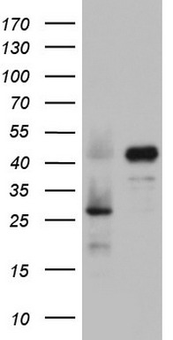 Mitocondrial Translational Initiation Factor 3 Antibody
