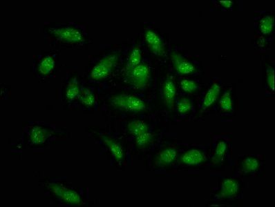 MKX Antibody