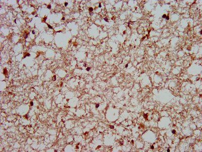 MKX Antibody