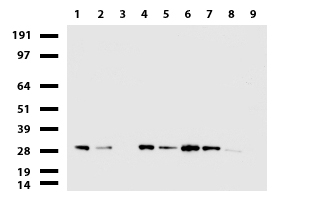 MYL6B Antibody