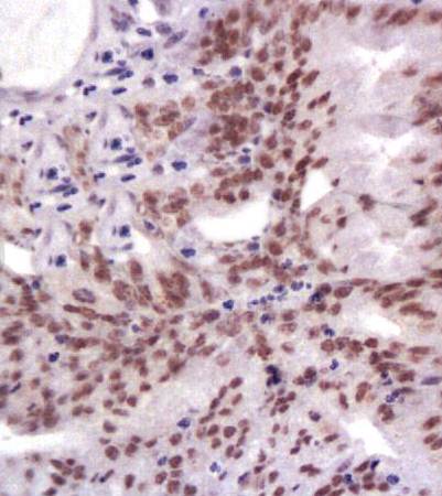 MLH1 Rabbit Polyclonal Antibody