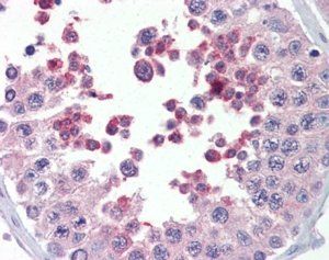 KMT2B/MLL4 Antibody