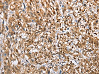 MMP12 Antibody
