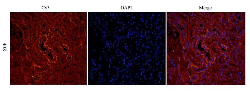 MMP15 Rabbit Polyclonal Antibody