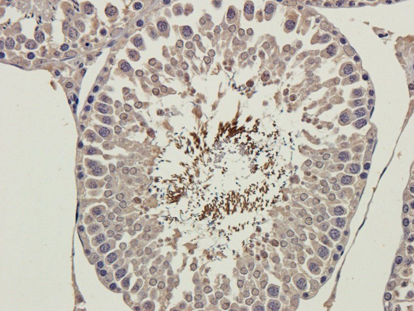 MMP15 Rabbit Polyclonal Antibody