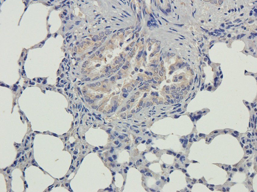 MMP15 Rabbit Polyclonal Antibody