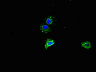 MMP2 Antibody