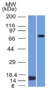 MMP2 Antibody