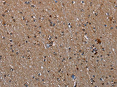 MMP23A Antibody