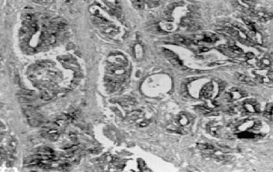 Mouse Human Matrix Metalloproteinase 3 (MMP3) Antibody