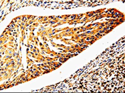 MMP3 Antibody