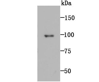 MMP9 Antibody