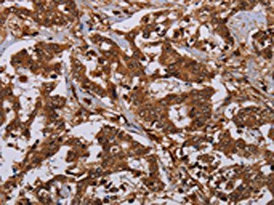 MOB1A Antibody