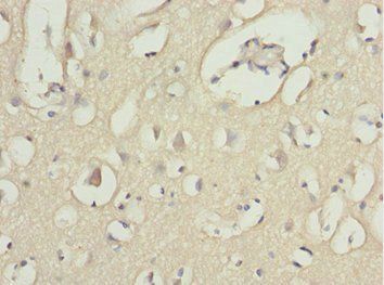 MOCS3 Antibody
