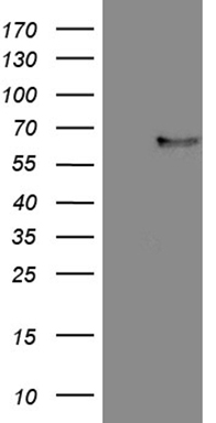 MKX Antibody