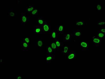 Mono-methyl-HIST1H3A (K36) Antibody