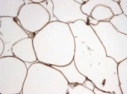 Rabbit Human Monoglyceride lipase Antibody