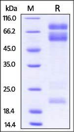 Mouse ADAM17 Protein, His Tag