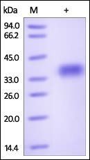 Mouse GPA33 Protein, His Tag