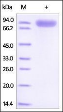 Mouse ROR1 Protein, Fc Tag