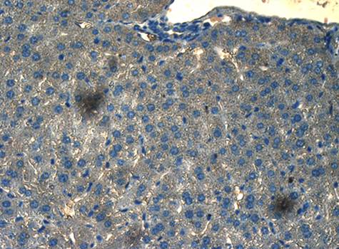 CD133 antibody