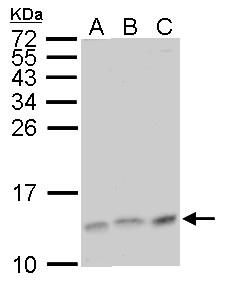 MP1 antibody [N1C3]