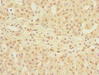 MPI Antibody