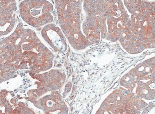 MPI Rabbit Polyclonal Antibody