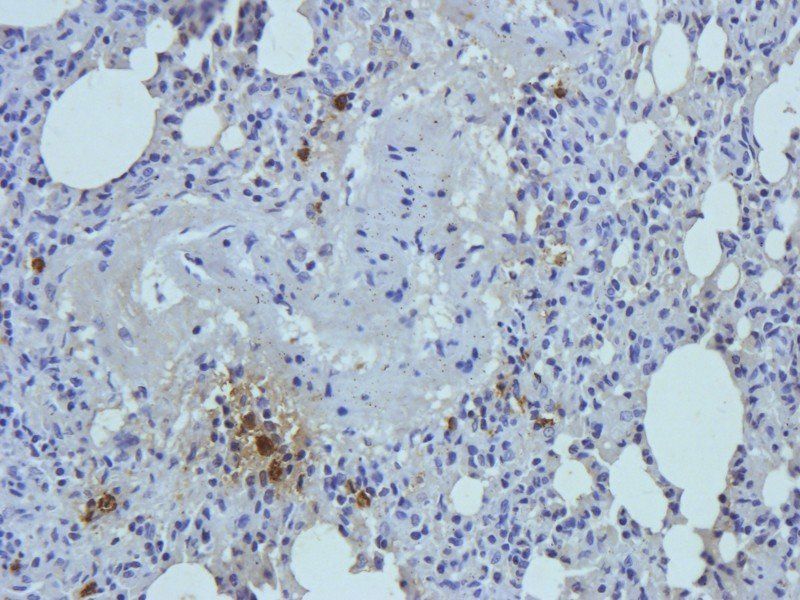 Myeloperoxidase Rabbit Polyclonal Antibody