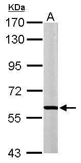 MPP2 antibody [N1C1]