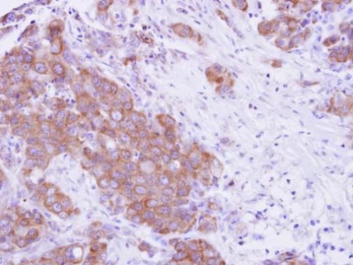 MPP3 Rabbit Polyclonal Antibody