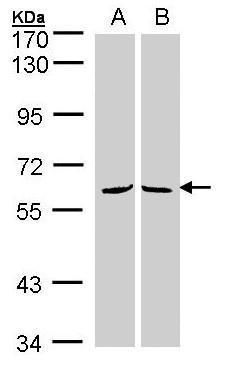 MPP3 Rabbit Polyclonal Antibody