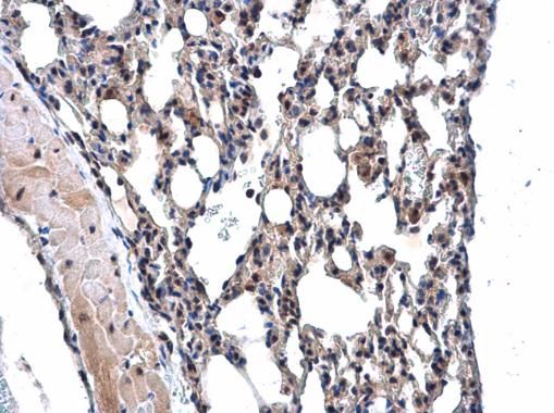 MPP3 Rabbit Polyclonal Antibody