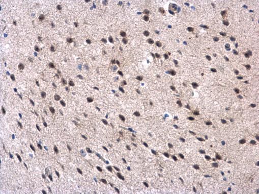 MPP3 Rabbit Polyclonal Antibody