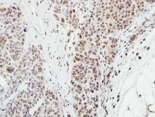 MPP3 Rabbit Polyclonal Antibody