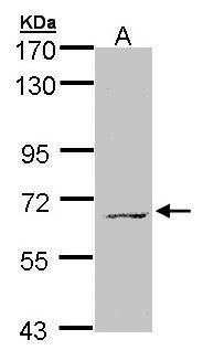 MPP3 Rabbit Polyclonal Antibody