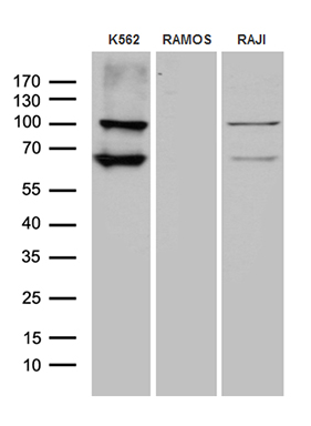 TTK Antibody
