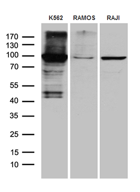 TTK Antibody