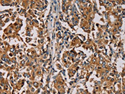 MRPL11 Antibody