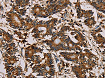 MRPL11 Antibody