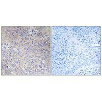 MRPL11 Antibody