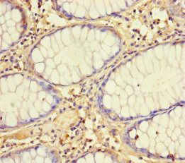 MRPL21 Antibody