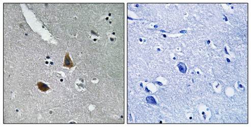 MRPL21 Antibody
