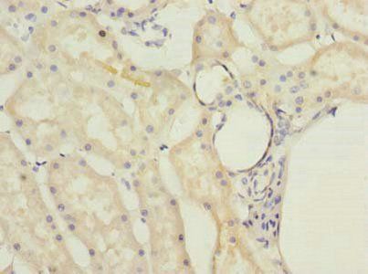MRPL22 Antibody