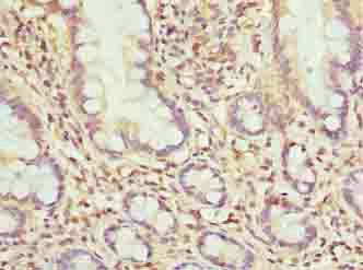 MRPL51 Antibody